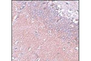 Immunohistochemistry of SYNGR4 in rat brain tissue with this product at 5 μg/ml (SYNGR4 Antikörper  (N-Term))