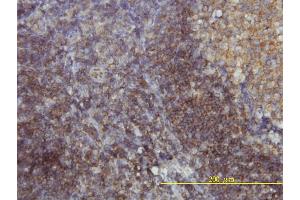 Immunostaining (ISt) image for anti-SH3-Domain GRB2-Like Endophilin B1 (SH3GLB1) (AA 1-365) antibody (ABIN565528)