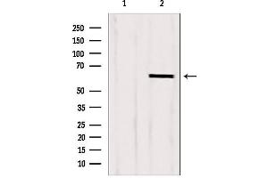 Western blot analysis of extracts from HepG2, using CKAP4 antibody. (CKAP4 Antikörper  (C-Term))