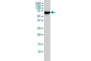 CARF monoclonal antibody (M02), clone 1A6 Western Blot analysis of CARF expression in Hela S3 NE .