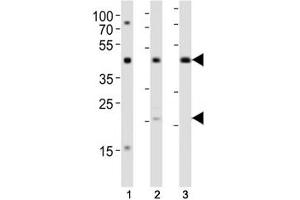 Western Blotting (WB) image for anti-Transforming Growth Factor, beta 1 (TGFB1) antibody (ABIN3029218)