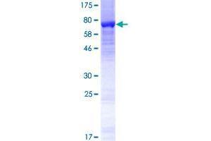 Image no. 1 for Tubulin, beta 7, Pseudogene (TUBB7P) (AA 1-434) protein (GST tag) (ABIN1324147) (TUBB7P Protein (AA 1-434) (GST tag))