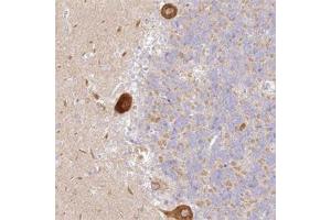 Immunohistochemical staining of human cerebellum with LRRC15 polyclonal antibody  shows strong cytoplasmic positivity in Purkinje cells at 1:20-1:50 dilution.