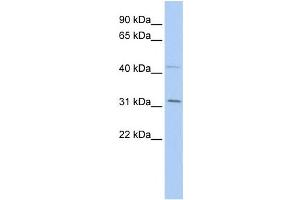 Western Blotting (WB) image for anti-SIX Homeobox 1 (SIX1) antibody (ABIN2457949) (SIX Homeobox 1 Antikörper)