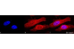 Immunocytochemistry/Immunofluorescence analysis using Rabbit Anti-Alpha B Crystallin Polyclonal Antibody . (CRYAB Antikörper  (Atto 488))