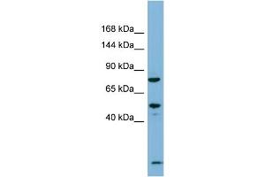Host:  Rabbit  Target Name:  PDZRN3  Sample Type:  Fetal Thymus lysates  Antibody Dilution:  1. (PDZRN3 Antikörper  (N-Term))