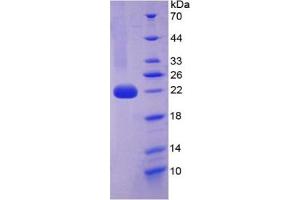 SDS-PAGE of Protein Standard from the Kit  (Highly purified E. (IL1A ELISA Kit)