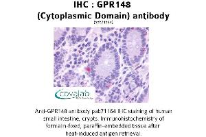 Image no. 1 for anti-G Protein-Coupled Receptor 148 (GPR148) (3rd Cytoplasmic Domain) antibody (ABIN1734951) (GPR148 Antikörper  (3rd Cytoplasmic Domain))