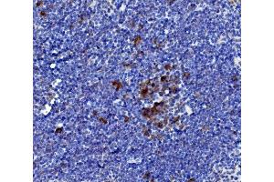 IHC analysis of IL-21/Il21 using anti-IL-21/Il21 antibody (ABIN7600316). (IL-21 Antikörper  (AA 18-146))