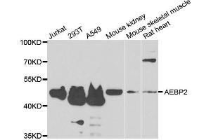 Western blot analysis of extracts of various cell lines, using AEBP2 antibody. (AEBP2 Antikörper)