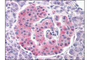 Human Pancreas (formalin-fixed, paraffin-embedded) stained with KCNJ11at 3. (KCNJ11 Antikörper  (Internal Region))