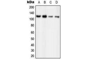 Western blot analysis of ORC1 expression in HeLa (A), MCF7 (B), PC12 (C), Ramos (D) whole cell lysates. (ORC1 Antikörper  (Center))