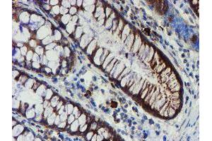 Immunohistochemical staining of paraffin-embedded Human colon tissue using anti-PPAT mouse monoclonal antibody.
