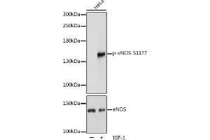 Western blot analysis of extracts of HeLa cells, using Phospho-NOS3-S1177 pAb (ABIN3020411, ABIN3020412, ABIN3020413 and ABIN1681908) at 1:1000 dilution or eNOS antibody (ABIN3022121, ABIN3022122, ABIN3022123 and ABIN6218610).