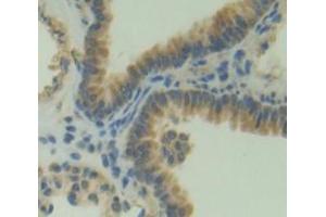 Immunohistochemistry (IHC) image for anti-Pleckstrin Homology Domain Containing, Family A (phosphoinositide Binding Specific) Member 1 (PLEKHA1) (AA 105-351) antibody (ABIN5014130)