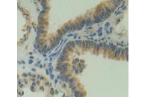 Used in DAB staining on fromalin fixed paraffin- embedded Kidney tissue (PLEKHA1 Antikörper  (AA 105-351))