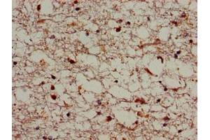 Immunohistochemistry of paraffin-embedded human brain tissue using ABIN7170339 at dilution of 1:100 (SORL1 Antikörper  (AA 525-744))
