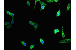 Immunofluorescent analysis of Hela cells using ABIN7175097 at dilution of 1:100 and Alexa Fluor 488-congugated AffiniPure Goat Anti-Rabbit IgG(H+L) (UNG Antikörper  (AA 114-224))