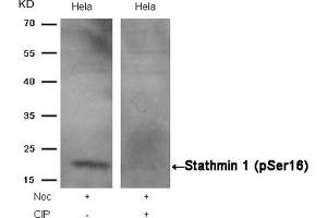 Western blot analysis of extracts from Hela cells, treated with Noc or calf intestinal phosphatase (CIP), using Stathmin 1 (Phospho-Ser16) Antibody. (Stathmin 1 Antikörper  (pSer16))