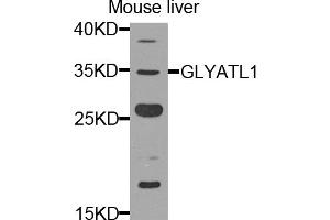 Western blot analysis of extracts of mouse liver, using GLYATL1 antibody. (GLYATL1 Antikörper)