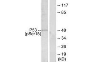 Western blot analysis of extracts from HeLa cells treated with HU, using p53 (Phospho-Ser15) Antibody. (p53 Antikörper  (pSer15))