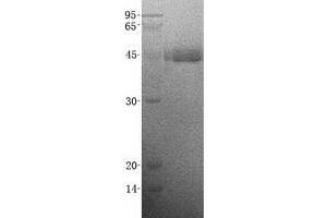 Validation with Western Blot (SFTPD Protein (His tag))