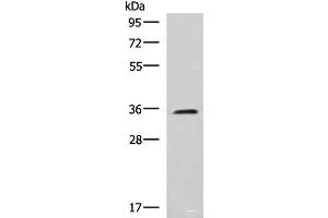 Western blot analysis of K562 cell lysate using JAM3 Polyclonal Antibody at dilution of 1:1000 (JAM3 Antikörper)