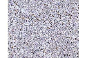 IHC analysis of Von Willebrand Factor/VWF using anti-Von Willebrand Factor/VWF antibody (ABIN7599909). (VWF Antikörper  (AA 1287-2770))