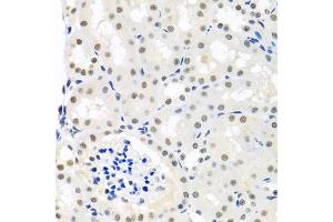 Immunohistochemistry of paraffin-embedded mouse kidney using THOC1 antibody (ABIN5974800) at dilution of 1/100 (40x lens). (THOC1 Antikörper)