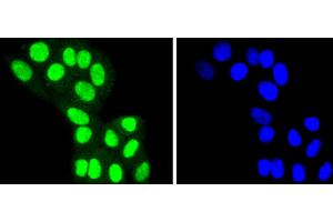 HepG2 cells were stained with HDAC8 (4C3) Monoclonal Antibody  at [1:200] incubated overnight at 4C, followed by secondary antibody incubation, DAPI staining of the nuclei and detection. (HDAC8 Antikörper)