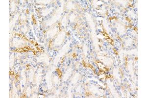 CD1a Antibody at 1/100 staining Rat kidney tissue by IHC-P. (CD1a Antikörper  (N-Term))