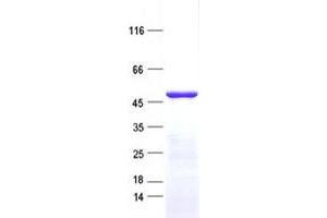 Western Blotting (WB) image for Zinc Finger Protein 643 (ZNF643) protein (His tag) (ABIN2736089)