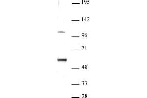 ELP3 antibody (pAb) tested by Western blot.