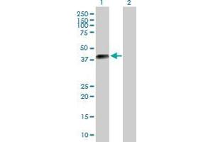Lane 1: DLK2 transfected lysate ( 40. (EGFL9 293T Cell Transient Overexpression Lysate(Denatured))