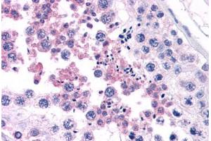 Human Testis (formalin-fixed, paraffin-embedded) stained with CAMP antibody ABIN343893 at 5 ug/ml followed by biotinylated goat anti-rabbit IgG secondary antibody ABIN481713, alkaline phosphatase-streptavidin and chromogen. (Cathelicidin Antikörper  (C-Term))