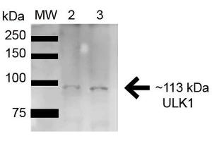 Western blot analysis of Rat Brain cell lysates showing detection of ~112. (ULK1 Antikörper  (AA 567-577) (APC))