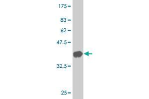 Western Blot detection against Immunogen (37. (Thyroglobulin Antikörper  (AA 2659-2768))