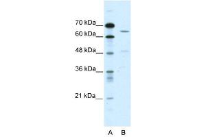 ACCN1 antibody used at 2 ug/ml to detect target protein. (ACCN1 Antikörper)