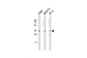 Western Blot at 1:1000 dilution Lane 1: K562 whole cell lysate Lane 2: MOLT-4 whole cell lysate Lane 3: PC-3 whole cell lysate Lysates/proteins at 20 ug per lane. (PIGC Antikörper  (AA 264-294))