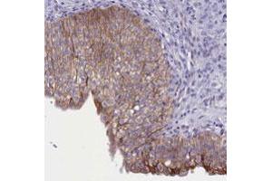 Immunohistochemical staining of human urinary bladder with TACSTD2 polyclonal antibody  shows moderate membranous positivity in urothelial cells. (TACSTD2 Antikörper)