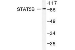 Western blot analysis of Stat5b antibody in extracts from HeLa cells. (STAT5B Antikörper)