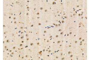 ABIN6260309 and ABIN6273995 at 1/100 staining Rat brain tissue by IHC-P. (BRD4 Antikörper  (N-Term))
