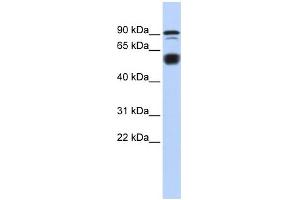 WB Suggested Anti-BCL11A Antibody Titration:  0. (BCL11A Antikörper  (N-Term))