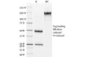 SDS-PAGE Analysis Purified Involucrin Mouse Monoclonal Antibody (SY5). (Involucrin Antikörper)