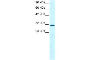 WB Suggested Anti-KLF8 Antibody Titration: 0. (KLF8 Antikörper  (N-Term))