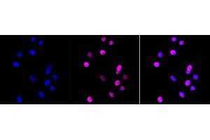 anti-Metastasis Associated 1 Family, Member 2 (MTA2) antibody