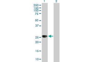 Western Blot analysis of ZNRF1 expression in transfected 293T cell line by ZNRF1 MaxPab polyclonal antibody. (ZNRF1 Antikörper  (AA 1-227))