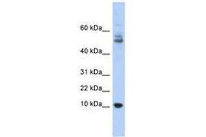 Image no. 1 for anti-Myotrophin (MTPN) (AA 35-84) antibody (ABIN6743678) (MTPN Antikörper  (AA 35-84))