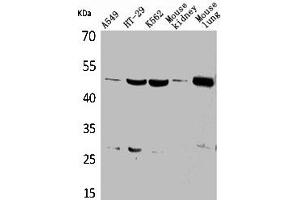 Western Blot analysis of A549 HT29 K562 mouse kidney mouse lung cells using GDI-2 Polyclonal Antibody (GDI2 Antikörper  (C-Term))