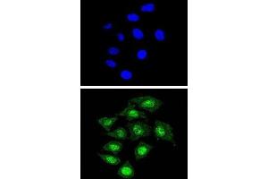 Immunofluorescence (IF) image for anti-Core-Binding Factor, beta Subunit (CBFB) antibody (ABIN3002868) (CBFB Antikörper)